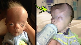 The mother abandoned her twins a doctor adopted them what he did next is hard to believe