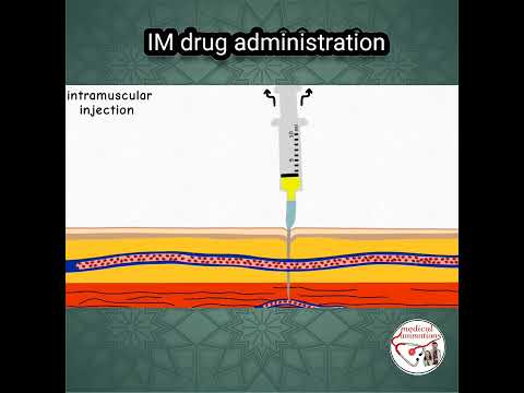 INTRAMUSCULAR (IM) INJECTION, PROCEDURE | ANIMATED EXPLANATION