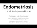 Endometriosis in all its shapes and forms