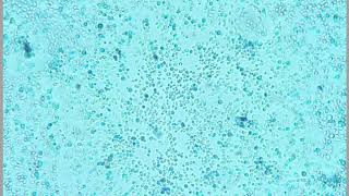 Active Yeast Cells Under the Microscope X40