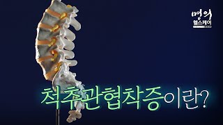 명의 헬스케어 - 척추관협착증이란?