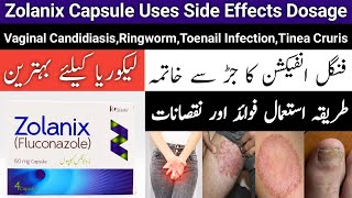 Zolanix Capsule Use In Urdu | Zolanix Fluconazole 150Mg Capsule