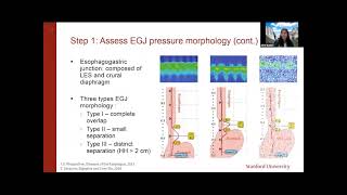 ANMS Clinical Virtual Webinar - Esophageal Manometry: When, Why, and How.