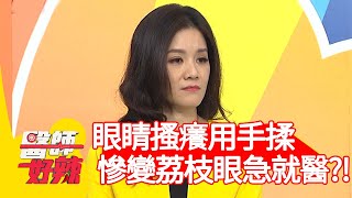 眼睛搔癢用手揉，慘變「荔枝眼」急就醫？！【#醫師好辣】20201214 part2 EP1066 田知學 徐小可