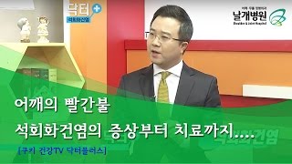 [쿠키 건강TV 닥터플러스] 어깨의 빨간불, 석회화건염의 증상 및 치료 / 날개병원 이태연 병원장 출연