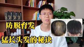 慧生元洗发水防脱发吗，推荐可靠的防脱生发宝贝。让您生发不是梦。