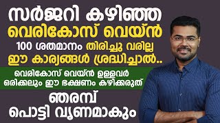 വെരികോസ് വെയ്ൻ ഉള്ളവർ ഒരിക്കലും ഈ ഭക്ഷണം കഴിക്കരുത് അത് പൊട്ടി വൃണമാവും |vericose vein malayalam