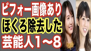 びっくり！ほくろを除去した芸能人1〜8位！あの美人タレントやイケメン俳優もホクロ整形していた…【世界の果てまで芸能裏情報チャンネル!】