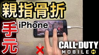 【CODモバイル】親指骨折した人必見！iPhone持てなくても諦めるな！iPhone親指無し2本指手元