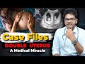 Case Files Ep4 : The Woman With An Extra Uterus | Dr. Anuj Pachhel