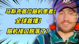 马斯克脑机首位患者，开直播用意识控制电脑，也太科幻了吧！