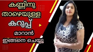 കണ്ണിനു താഴെ കറുപ്പ്, തടിപ്പ്, നീര് കാരണങ്ങൾ പ്രതിവിധികൾ  /eye care and exercise @cathysworld5400