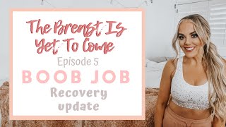 BOOB JOB | RECOVERY UPDATE | 2 MONTHS POST-OP | SCAR TREATMENT | HOW TO TREAT SURGICAL SCARS