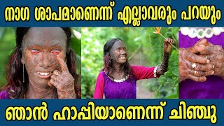 ദേഹത്ത്‌ തൊലി പൊളിയുന്നന്നേയുള്ളൂ  ഞാനും  മനുഷ്യനാണ്‌   ചിഞ്ചു ഒരു മാതൃകയാണ് | Chinju Antony |