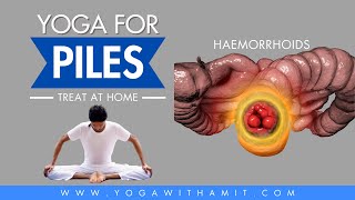 Hemorrhoids Treatment Exercise | 2 min Piles Exercise at Home