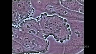 Mitosis in an Animal Cell Under the Microscope