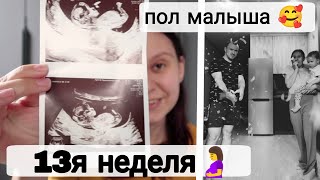 Первый Скрининг | Узнали Пол Малыша 🥰 | Когда ПДР | 13 я Неделя Беременности🤰