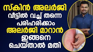 സ്കിൻ അലർജി ഇനി വീട്ടിൽ നിന്നും തന്നെ പരിഹരിക്കാം| skin allergy treatment at home..