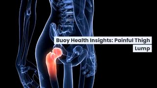 Painful Thigh Lump: Common Causes and When to Seek Medical Care | BuoyHealth.com