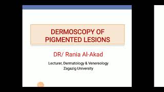 Rania Alakad: Dermoscopy of pigmented lesions 1