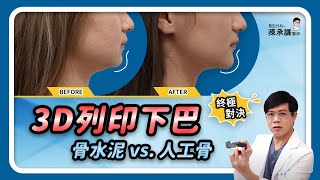 3D列印墊下巴終極二選一！人工骨vs 骨水泥到底哪個好？ - 陳承謙醫師