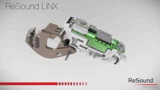 How to change housing on ReSound LiNX 61 | For Professionals