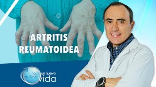ARTRITIS REUMATOIDEA - HACIA UN NUEVO ESTILO DE VIDA