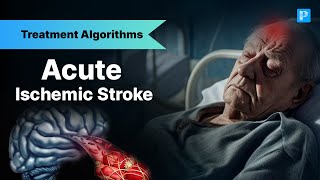 The Shocking Truth About Stroke Management No Doctor Tells You