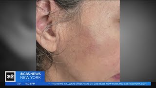 56-year-old woman recounts random attack by man on Upper West Side
