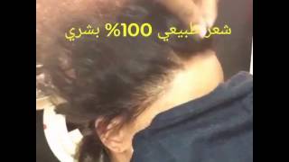 مشاكل الشعر و حلول ( قطعه اماميه قذله ) lace frontal