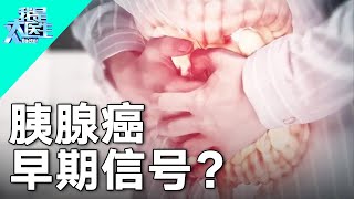 癌中之王的克星 没事吃点它 杀死体内癌细胞【我是大医生】