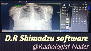 شرح مبسط لسوفت وير جهاز دي آر شيمادزو|DR   . Shimadzu