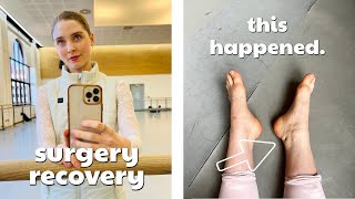 A Month in the Life of a Ballet Dancer Recovering From Surgery