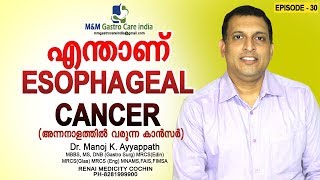 എന്താണ് esophageal cancer (അന്നനാളത്തിൽ വരുന്ന കാൻസർ)| M\u0026M Gastro Care India | epi-030