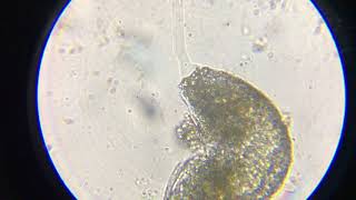 Testate amoeba 1000x