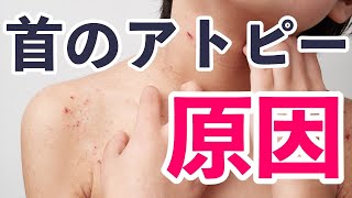 首のアトピーで内側から湧き起こるかゆみの見つけ方