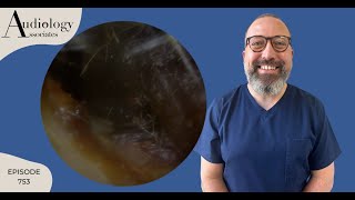 HARD EAR WAX PLUG/ INFECTION DEBRIS REMOVAL - EP753