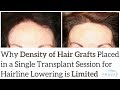 Why Hair Graft Density in a Single Hairline Lowering Session is Limited to Ensure Graft Survival