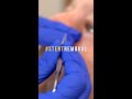 Stent Removal After Lacrimal Tear Duct Surgery