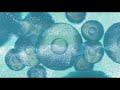 boost immune system music cleaning of viruses infections bacteria fungus toxins 741 hz