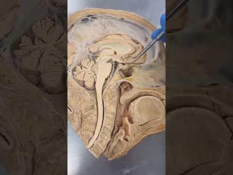 Is the pituitary gland the largest gland?