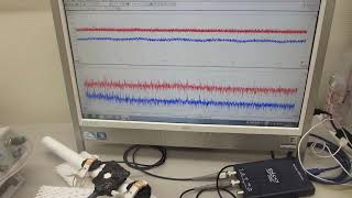 基礎実験ーーメガヘルツ超音波を利用した「振動技術」（振動モードの改善・調整）