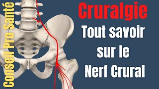 Cruralgie : Qu'est ce que le nerf crural / nerf fémoral ?