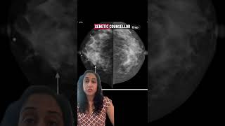 Busting #breastcancer myths: Commercial genetic testing is as good as medical #genetictesting