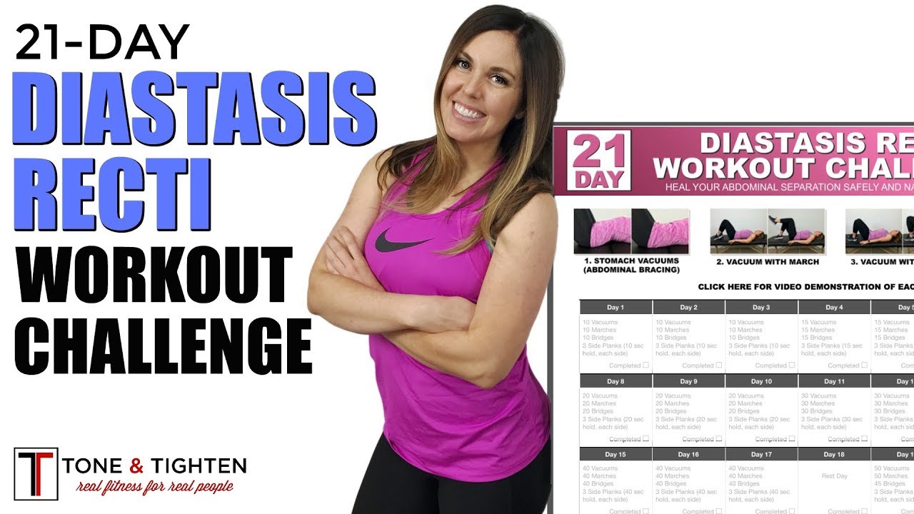 21-Day Diastasis Recti Workout Challenge - Post Pregnancy Ab Challenge ...