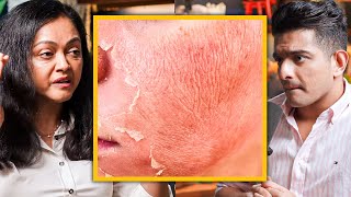 CELEBRITY SKIN CARE Secret - "Skin Peels" Explained By Bollywood's Dermat Dr.Rashmi