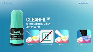 NL CLEARFIL Universal Bond Quick Commercial