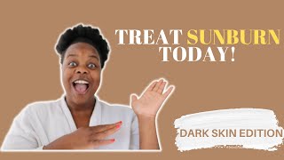 5 WAYS TO TREAT SUNBURN FOR DARK SKIN I NAMIBIAN YOUTUBER