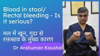 Blood in stools, Rectal bleeding causes explained. गुदा से रक्तस्राव (मल में रक्त) कारण और उपचार