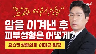 암을 이겨낸 이들의 성형수술 (오스킨성형외과 이태근) [대한성형외과학회 LIVE] #2